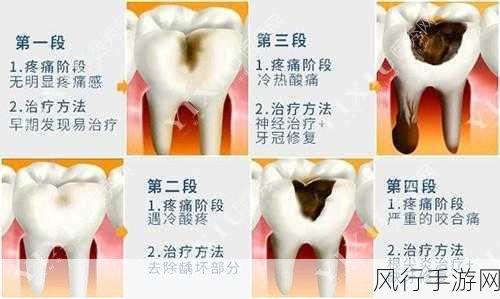 揭秘虫牙真相，并非牙齿中有虫那么简单