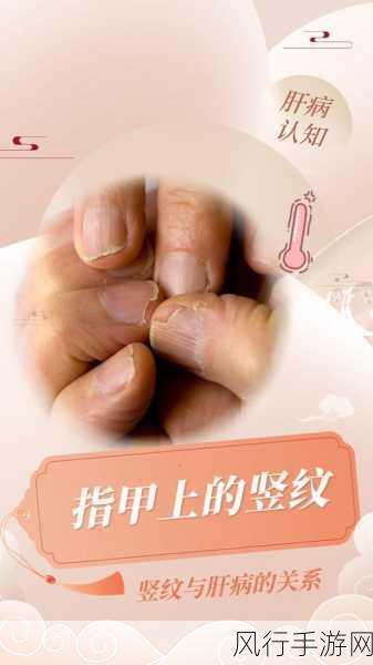 指甲上的竖纹,究竟隐藏着怎样的健康密码?