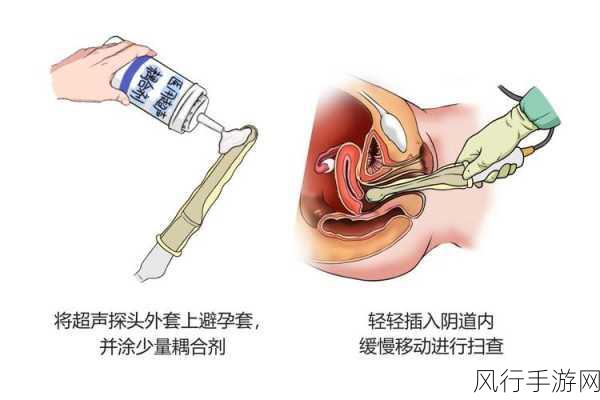 揭秘超声检查中耦合剂的奥秘