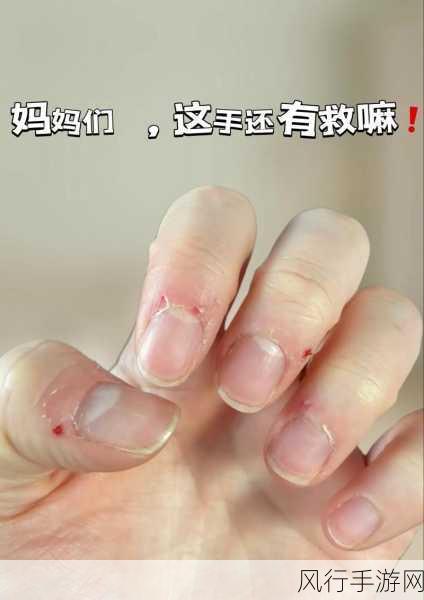 缺乏维生素与指甲周围长倒刺的那些事儿