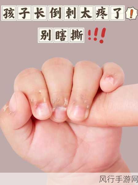 缺乏维生素与指甲周围长倒刺的那些事儿